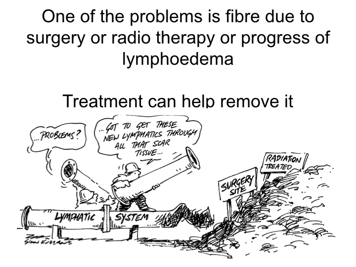 Lymphoedema treament